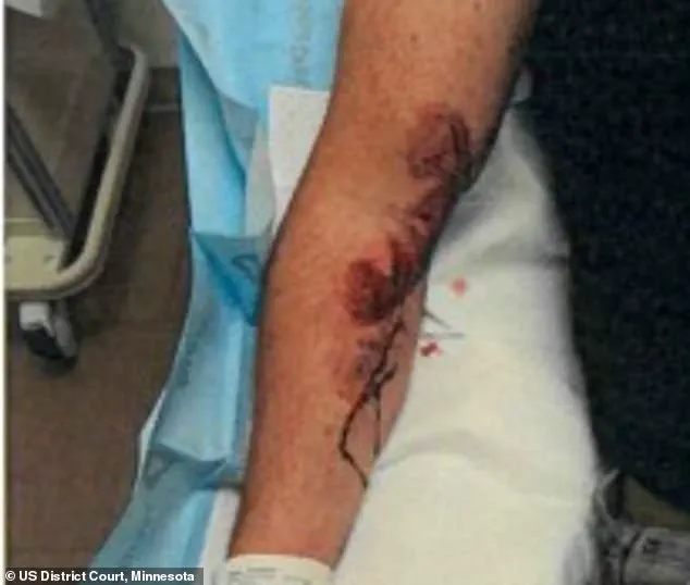 ICE Agent Involved in Fatal Shooting Discloses Scars from Previous Encounter in Court Testimony