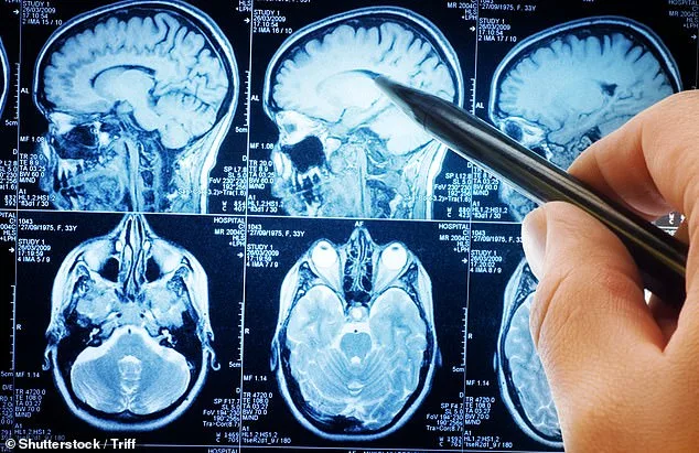 Beyond Tremors: Four Critical Early Signs of Parkinson's You Must Not Ignore