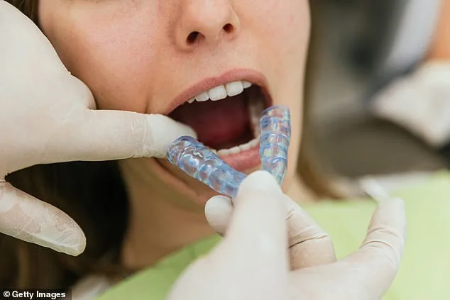 Bruxism: A Silent Culprit Behind Chronic Pain and Dental Damage