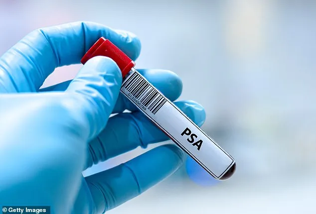 Study Suggests Metformin Could Cut Prostate Cancer Risk by Over a Third