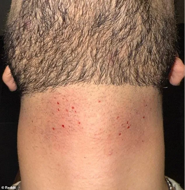 The Rise of Gentler Shaving Tools and the Hidden Skin Risks They Pose