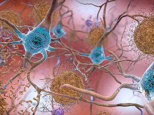 Common Antidepressant Fluvoxamine Shows Promise in Treating Long COVID Fatigue