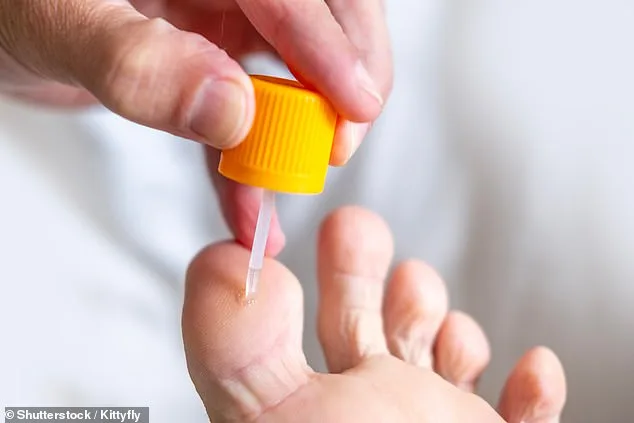 Why the NHS Turns Its Back on Warts—and What You Can Do About It