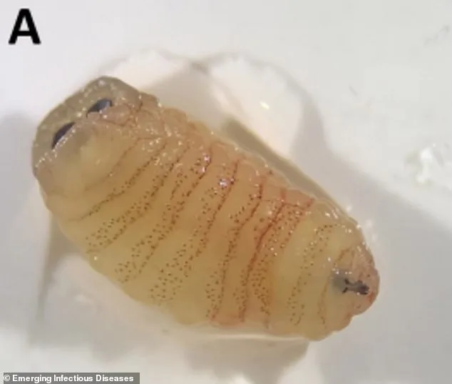 Bizarre Case of Greek Sheep Farmer: Woman Expels Parasites from Nose After Persistent Illness